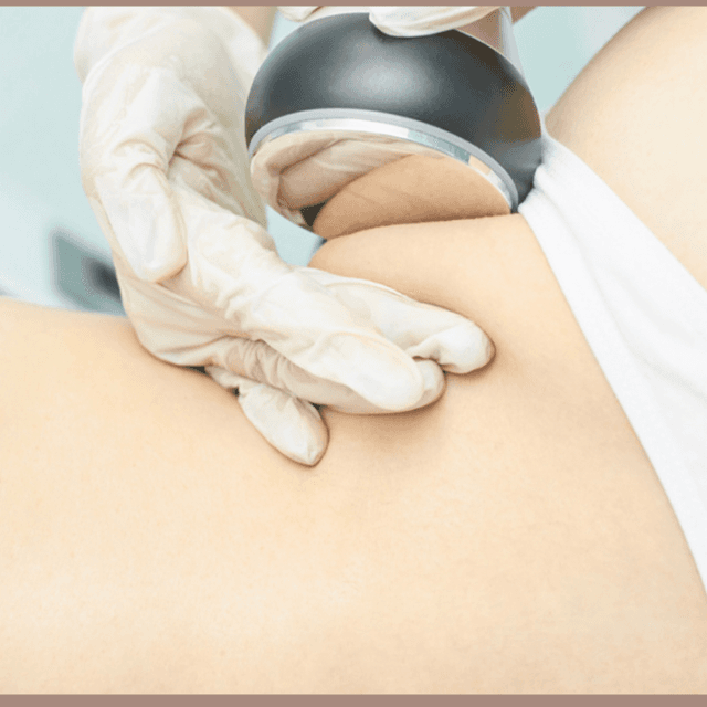 VIVE & RF Cavitation Combo at Sculpt and Lift Temecula in Temecula, CA
