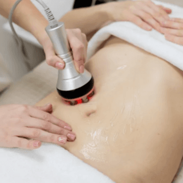 WINTER RF CAVITATION SPECIAL!! at Sculpt and Lift Temecula in Temecula, CA